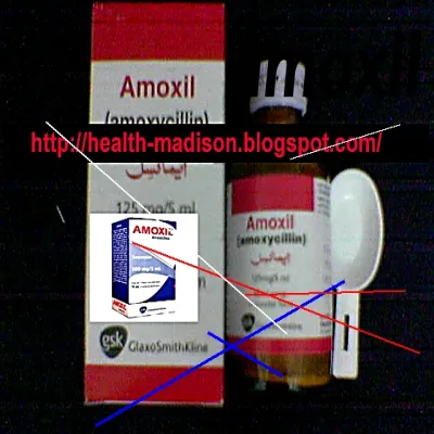 Amoxil 1g prix